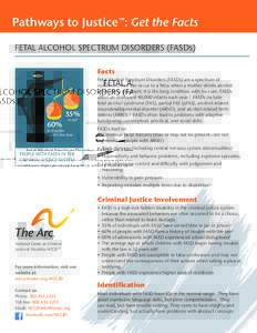 Syndromes / Teratogens / Alcohol / Medicine / Fetal alcohol spectrum disorder / Drinking culture / Fetal alcohol syndrome / Alcoholism / Neurodevelopmental disorder / Alcohol abuse / Health / Mental retardation