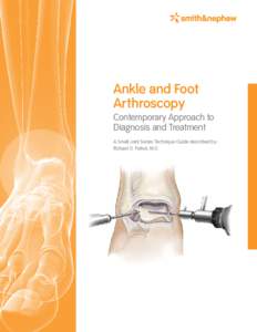 Ankle and Foot Arthroscopy Contemporary Approach to Diagnosis and Treatment A Small Joint Series Technique Guide described by: Richard D. Ferkel, M.D.