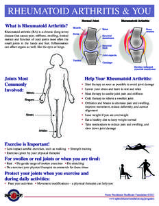 Arthritis / Aging-associated diseases / Connective tissue diseases / Autoimmune diseases / Rheumatoid arthritis / Arthralgia / Physical therapy / Joint / Osteoporosis / Medicine / Health / Rheumatology