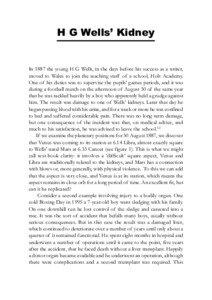 H G Wells Kidney  In 1887 the young H G Wells, in the days before his success as a writer,