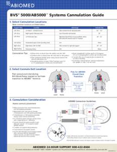 Medical equipment / Cannula / Medical technology