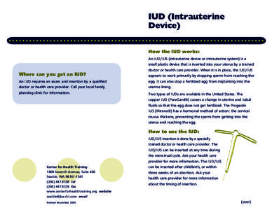 IUD (Intrauterine Device) How the IUD works: Where can you get an IUD? An IUD requires an exam and insertion by a qualified