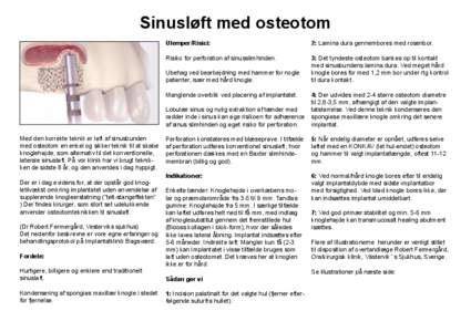 Sinusløft med osteotom Ulemper/Risici: 2: Lamina dura gennembores med rosenbor.  Risiko for perforation af sinusslimhinden.