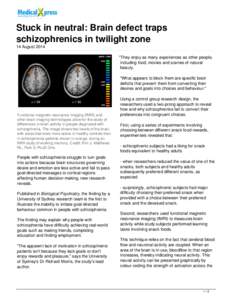 Stuck in neutral: Brain defect traps schizophrenics in twilight zone