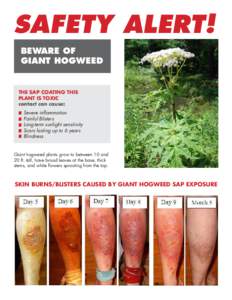 SAFETY ALERT! BEWARE OF GIANT HOGWEED The sap coating this plant is TOXIC