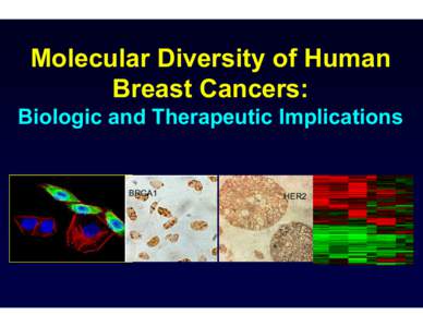 Molecular Diversity of Human Breast Cancers: Biologic and Therapeutic Implications BRCA1