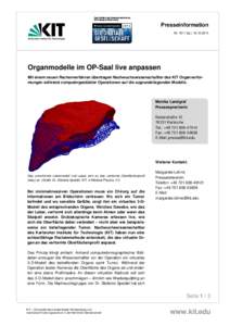 Organmodelle im OP-Saal live anpassen