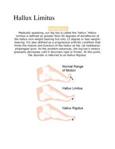 Hallux Limitus Definition Medically speaking, our big toe is called the ‘hallux.’ Hallux Limitus is defined as greater than 50 degrees of dorsiflexion of the hallux non-weight bearing but only 12 degree or less weigh