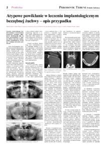 2  PERIODONTIC TRIBUNE Polish Edition Praktyka