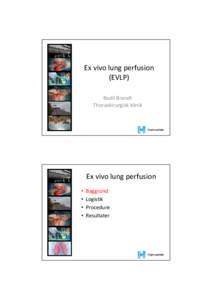 Ex vivo lung perfusion (EVLP) Bodil Brandt Thoraxkirurgisk klinik  Ex vivo lung perfusion