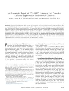 Arthroscopic Repair of ``Peel-Off'' Lesion of the Posterior Cruciate Ligament at the Femoral Condyle