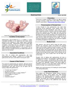 Childbirth / Pregnancy / Gastroschisis / Abdominal wall defect / Preterm birth / Prenatal diagnosis / Prenatal care / March of Dimes / Unassisted childbirth / Medicine / Health / Obstetrics