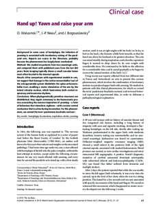 Clinical case Hand up! Yawn and raise your arm O. Walusinski1, J.-P. Neau2, and J. Bogousslavsky3 Background In some cases of hemiplegia, the initiation of yawning is associated with involuntary raising of the paralysed