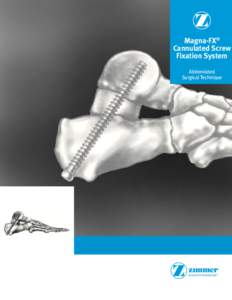 Magna-FX® Cannulated Screw Fixation System Abbreviated Surgical Technique