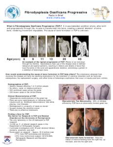 Fibrodysplasia Ossificans Progressiva Facts in Brief WWW.IFOPA.ORG  What is Fibrodysplasia Ossificans Progressiva (FOP)? A musculoskeletal condition where, after birth