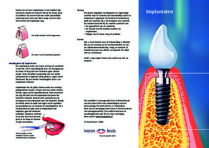 Nadat een of meer implantaten in het kaakbot zijn verankerd, plaatst de tandarts hierop de kroon, brug of prothese. Hij neemt daarvoor onder plaatselijke verdoving soms eerst een klein stukje van het tandvlees boven het 