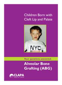 Children Born with Cleft Lip and Palate Your questions answered:  Alveolar Bone