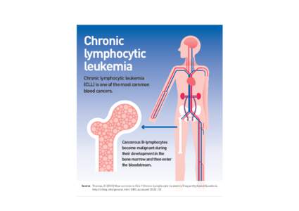 Hematology / B-cell chronic lymphocytic leukemia / Lymphoid leukemia / Hematological malignancy / Leukemia / Childhood leukemia / Nicholas Chiorazzi / Lymphocytic leukemia / Oncology / Medicine