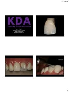 [removed]KDA Friday, March 14, 2014 9:00 a.m. – 1:00 p.m. “REPAIRING PORCELAIN CROWNS”