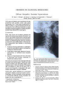 Health / Musculoskeletal disorders / Diffuse idiopathic skeletal hyperostosis / Lumbar spinal stenosis / Human vertebral column / Ankylosing spondylitis / Zygapophysial joint / Degenerative disc disease / Ankylosing hyperostosis / Anatomy / Vertebral column / Medicine