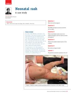 clinical  Neonatal rash A case study Kwa Siew Kim Davendralingham Sinniah