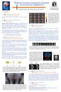 Magnetic resonance imaging developments for neuroscience applications [  Opportunities at the Brain Research Institute