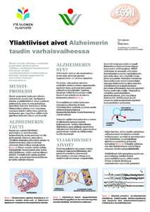 Yliaktiiviset aivot Alzheimerin taudin varhaisvaiheessa Muisti on kyky tallentaa, varastoida ja palauttaa mieleen tietoa. Tutkimus on lisännyt huomattavasti tietoamme aivojen