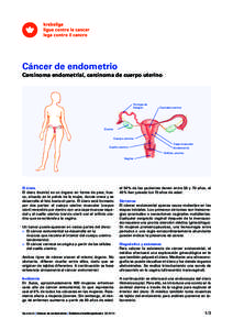 Cáncer de endometrio Carcinoma endometrial, carcinoma de cuerpo uterino Trompa de Falopio