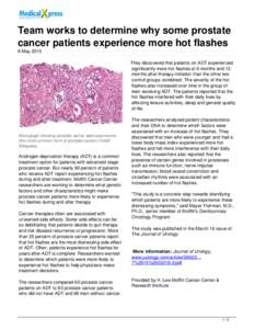 Team works to determine why some prostate cancer patients experience more hot flashes