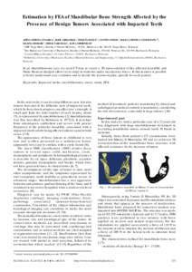 Estimation by FEA of Mandibular Bone Strength Affected by the Presence of Benign Tumors Associated with Impacted Teeth ADINA SIMONA COSARCA1, RADU GRIGORAS1, VIOLETA HANCU2, COSTIN COMAN2, RALUCA MONICA COMANEANU2*, LILI