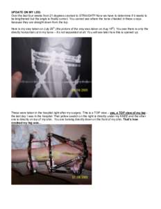 Bone / Biology / Radiography / Electromagnetic spectrum / X-ray