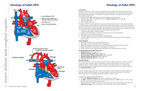 Tetralogy of Fallot (TET)  Tetralogy of Fallot (TET) In General  heart defects and surgical repairs