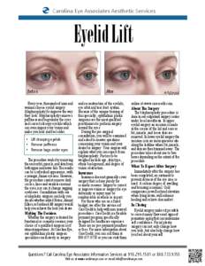 Carolina Eye Associates Aesthetic Services  Eyelid Lift