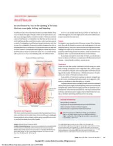 JAMA PATIENT PAGE | Digestive System  Anal Fissure An anal fissure is a tear in the opening of the anus that can cause pain, itching, and bleeding. Anal fissures are common in infants but less so in older children. They