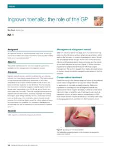 FOCUS  Ingrown toenails: the role of the GP Alan Bryant, Andrew Knox  Background