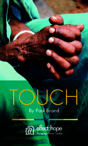 TOUCH By Paul Brand Dr. Paul Brand joined The Leprosy Mission in 1953 as an orthopeadic surgeon.
