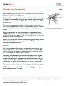 .org Shoulder Joint Replacement Page[removed]Although shoulder joint replacement is less common than knee or hip replacement,