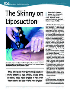 The Skinny on Liposuction