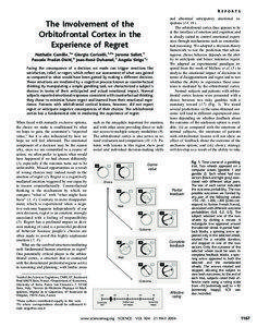 Cerebrum / Limbic system / Emotions / Critical thinking / Decision theory / Orbitofrontal cortex / Decision making / Disappointment / Regret / Brain / Cognitive science / Anatomy