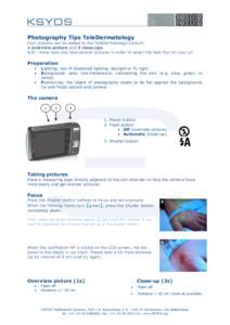 Photography Tips TeleDermatology Four pictures can be added to the TeleDermatology Consult: 1 overview picture and 3 close-ups. N.B.: make sure you take several pictures in order to select the best four on your pc.  Prep