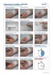 Anwendung des Detektor CANCER01 (Bitte beachten sie auch die Gebrauchsanweisung) Legen der Verweilkanüle Entfernung der Nadel