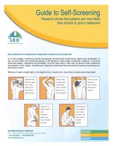 Guide to Self-Screening Research shows that patients are more likely than doctors to spot a melanoma Early detection of melanoma is essential to improve the prognosis In its early stages, melanoma can be successfully rem