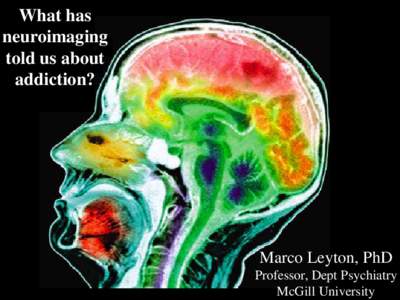 What has neuroimaging told us about addiction?  Marco Leyton, PhD