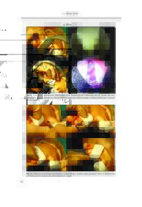 J. Borne et al.  Fig. 13 : Neurolyse mini-invasive endoscopique avec introduction de l’endoscope puis de la lame par voie interdigitale, visualisation puis section du LIMP qui apparaît en blanc continu (en haut à dro