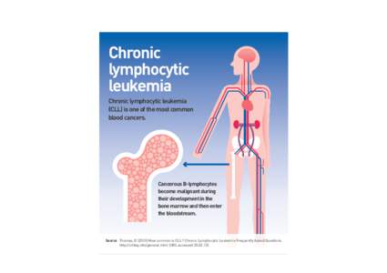 CLL01  Chronic lymphocytic leukemia Chronic lymphocytic leukemia