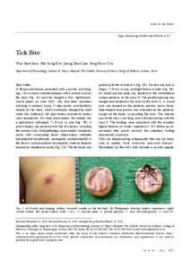 Cho / Tick-borne disease