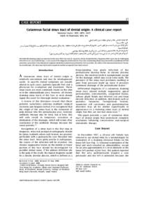 37  CASE REPORT Cutaneous facial sinus tract of dental origin: A clinical case report Mansour Assery*, BDS, MPH, AACP Saleh Al Shamranit, BDS, MS