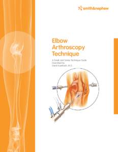 Elbow Arthroscopy Technique A Small Joint Series Technique Guide Described by: David Auerbach, M.D.