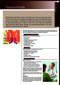 HAEMORRHOIDS  Haemorrhoids Haemorrhoids, also known as piles, are swollen veins in the anus and lower rectum. These are caused by the increased intra-abdominal pressure restricting blood flow