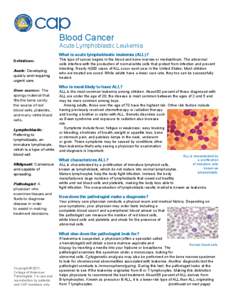 Blood Cancer  Acute Lymphoblastic Leukemia What is acute lymphoblastic leukemia (ALL)? Definitions Acute: Developing